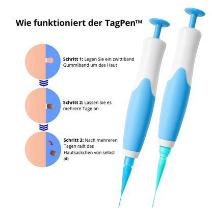 Lush TagPen Kit™ | Hautanhängsel einfach zu Hause entfernen