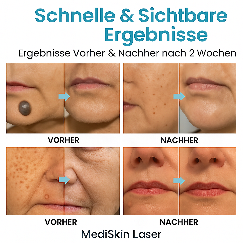 Lush MediSkin Laser | Sanft Zu Perfektion