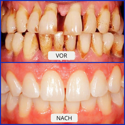 Lush | Bee Venom Zahnpasta