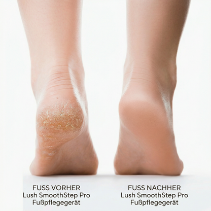 Lush SmoothStep Pro Fußpflegegerät
