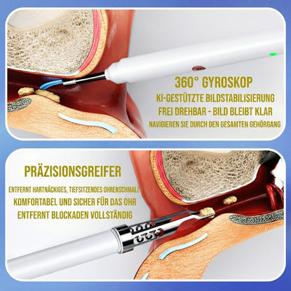 Lushy Tür | Vom Arzt empfohlene Technologie für die Ohrengesundheit